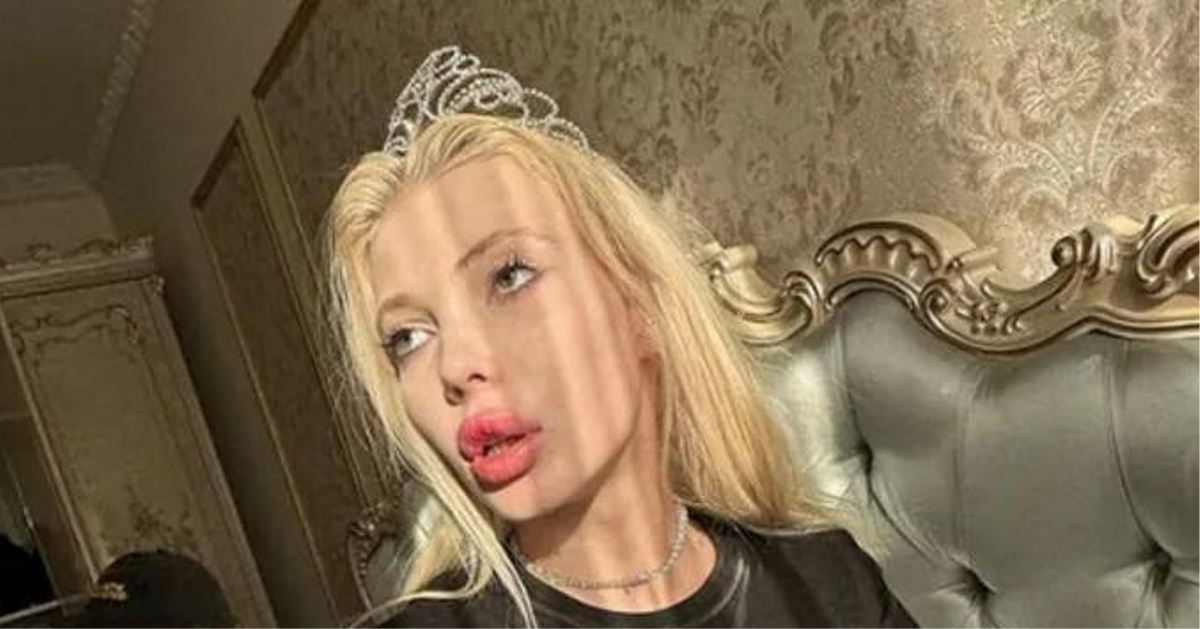 Девушка Паши Техника чудом выжила после падения с многоэтажки и рассказала, что случилось